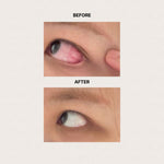 Load image into Gallery viewer, EyeAg+ Value Combo-6 Boxes